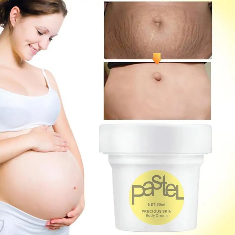 Maternity Stretch Marks Cream