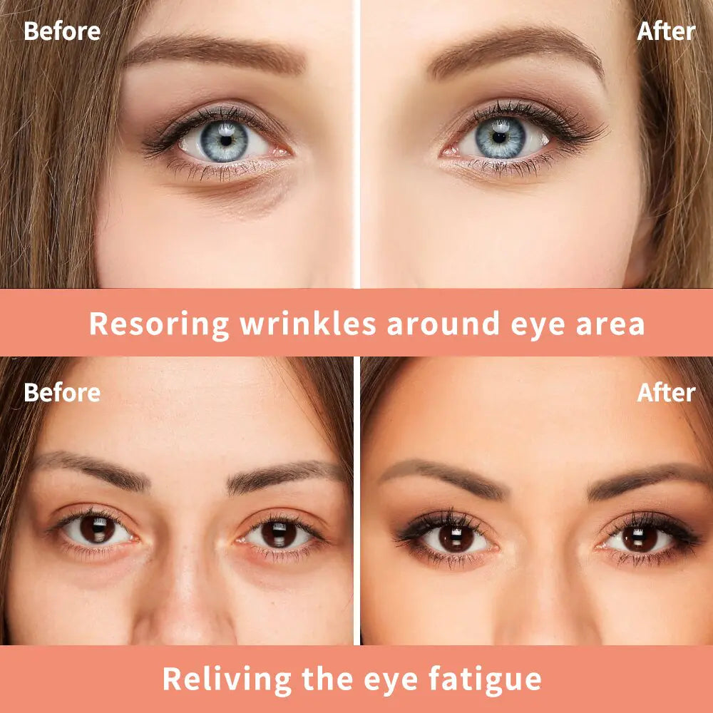 HydraGlow Eye Rejuvenating Cream