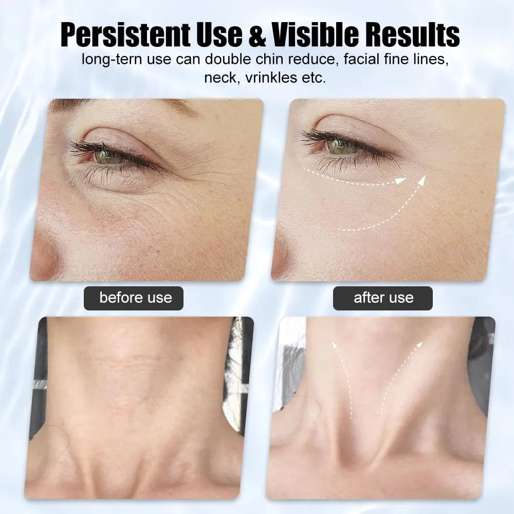 Firming Wrinkle Beauty Device