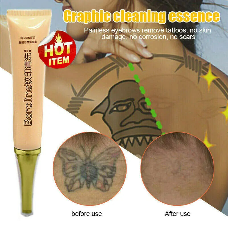 Permanent Tattoo Cream Removal